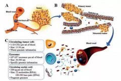 微流控系统分离CTCs方法及背景介绍