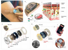 基于ISF检测方法完全集成的、可穿戴微针阵列设