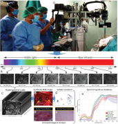 <b>短波红外成像使人脑肿瘤的高对比度荧光引导手</b>