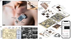 全集成无线可穿戴超声波贴片随时随地监测人体