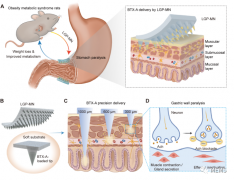 新型微针递送系统首次实现胃壁的分层精准递药