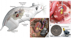 用于肾移植排斥反应早期检测的植入式柔性生物