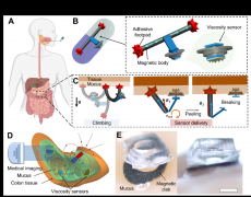 用于粘液生理特性原位传感的无线微型生物传感