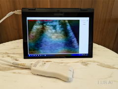 基于INTEL 11代芯片Tiger Lake 在OPENVINO AI 套件上所开