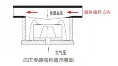 智芯传感ZXP4系列一次性血压传感器介绍