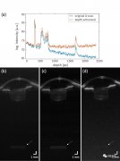 新型VCSEL提供更简单、更便宜的光学相干断层扫描