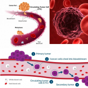 利用微流控芯片高通量收集血液中的循环肿瘤细