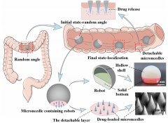 微针机器人实现结肠给药的快速自定位和抗蠕动