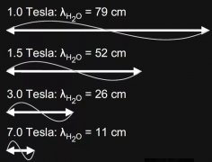 科普一下MR双射频技术的相关知识