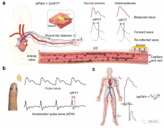<b>基于可穿戴离子电子传感器单点指尖脉冲监测的</b>
