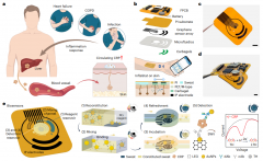 可穿戴电化学传感器监测汗液中代谢和营养物质