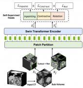 新型transformer模型实现3D医学图像分析最新基准