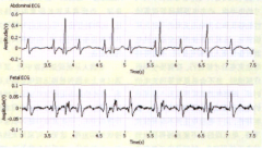 利用LabVIEW图形化开发平台实现医疗电子设备原型