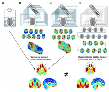 经颅电刺激系列之交叉短脉冲刺激 ISP