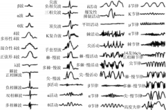 脑电时域分析系列之脑电节律概述