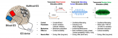 经颅电刺激系列之高精度经颅电刺激HD-TES