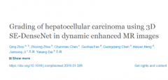 AI医学影像研究新突破 为肝癌患者无创分级