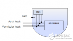 半导体技术推动医疗创新 尤其在医疗健康技术领
