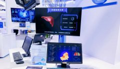 商汤“SenseCare®智慧医院”亮相CHIMA，大模型赋能