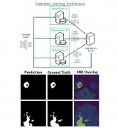 医学院正在研究一个人工智能,可以帮助识别脑瘤