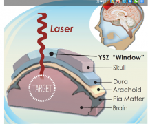 为头骨打造出“可视窗户”技术出炉，对大脑的