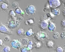 新型抗癌疫苗递送载体研制成功：利用蜘蛛丝获