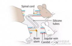 <b>遗体换头手术成功，换头手术离真正的成功还远</b>