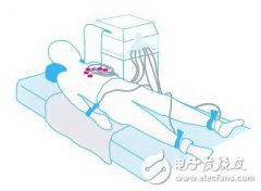 高可靠性心脏监护仪设计详解