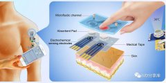 用于人体汗液和体温多功能检测的可穿戴微流控
