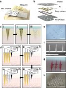 无线可穿戴贴片有望成为治疗慢性病的药物递送