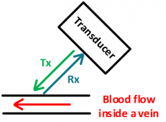 高精度ADC如何提高CW多普勒超声的准确性