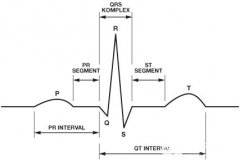 <b>检测和区分心脏起搏伪像</b>