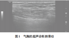 基于气胸超声诊断的基本原理、实现与分析