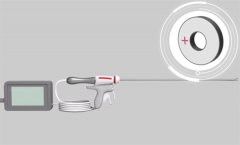 切割止血刀换能片：细微之处显卓越，让超声刀