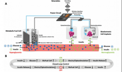 可植入血糖驱动代谢燃料电池用于血糖水平的持