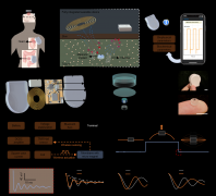 新型植入式传感器+可穿戴设备，实现无线物理生