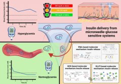 基于葡萄糖响应性微针的胰岛素透皮给药系统研
