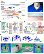 基于传感器的全集成可延展器件平台用于喉部康