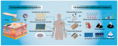 基于皮肤的超声激活微型器件在智能给药与诊断