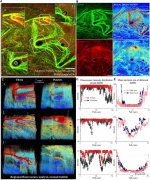 基于气泡自适应行为的智能凝血诊断微流控平台