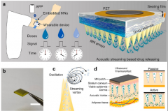 用于智能药物递送的可穿戴声学响应微针阵列