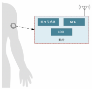 智能电池电量计如何有效改进动态血糖监视仪的