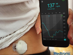 基于微波传感原理的无创血糖监测系统