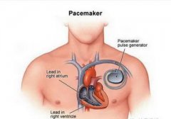 <b>意外·科技之医疗篇</b>