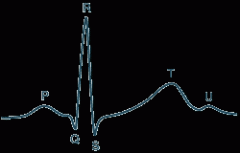 ECG前端设计通过微型转换器简化
