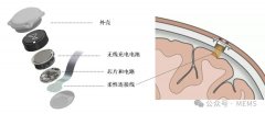 基于MEMS超声波方案的“真”无线植入式脑机接口