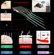 类蚊口器的仿生神经探针实现硬脑膜外微创植入